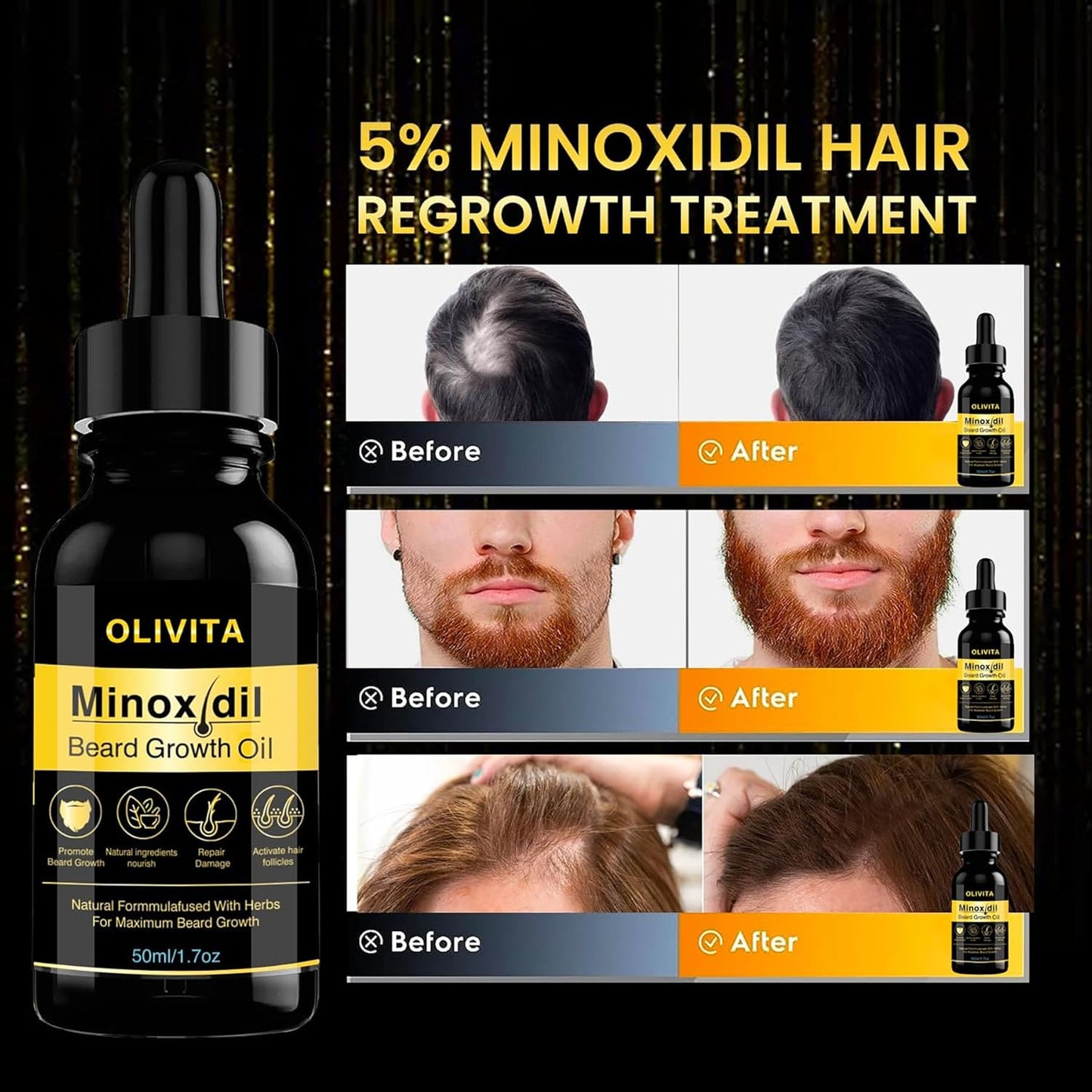 Minoxidil Beard and Hair Growth Serum